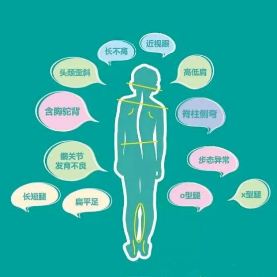 警惕！孩子的“小毛病”或是体态危机——濮阳油田总医院五一免费筛查守护成长(图1)