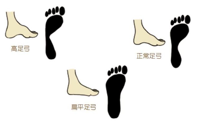 警惕！孩子的“小毛病”或是体态危机——濮阳油田总医院五一免费筛查守护成长(图4)